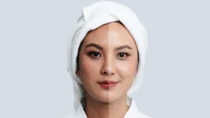 Pigmentation ' The Full Story